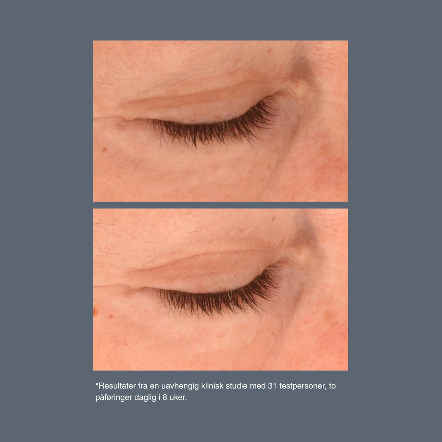 Phyto Nature Lifting Eye Cream 15ml