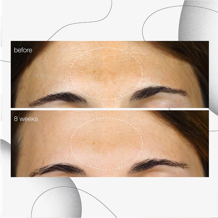 Power Dark spot serum 30 ML Serum