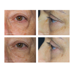 Awaken peptide eye gel 15 ML Øyeprodukter