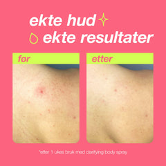 Clarifying Body Spray 177ml Kroppsprodukter
