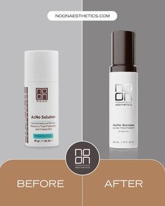 Noon Aesthetics AcNo Solution Serum