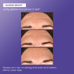 Phyto nature E2 peeling med eksosomer 100 ML Toner/Peeling