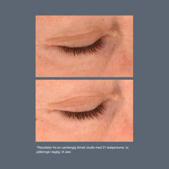 Phyto Nature Lifting Eye Cream 15ml