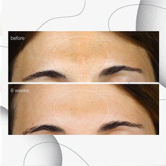 Power Dark spot serum 30 ML Serum